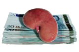 Iran’s Kidney Business Model shows the way
