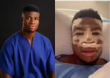 I didn’t pay for my nose surgery – Nigerian comedian Zicsaloma clarifies