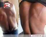 Media General condemns brutal assault on North East Regional Correspondent