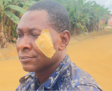 Two police officers injured in Kukurantumi clash after suspect’s death