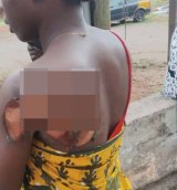 Jealous boyfriend allegedly sets girlfriend on fire, stepdaughter sustains burn injury at the back