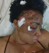 Angela Okorie reveals bullet fragments still in her head after 2019 assassination attempt