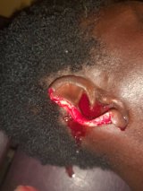 Man ‘chews’ off wife’s ear in a scuffle in Dambai