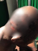 Okada rider survives brutal machete attack in Boinso, suspect arrested