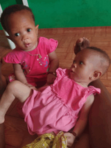 Parents of twin babies appeal for urgent help to save child with a critical heart defect