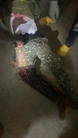 Photos: Ghana Immigration officers ambushed and shot in Upper East Region’s Tempane district