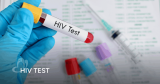 48,580 HIV test kits distributed to men