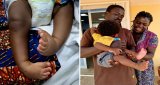 Healing with Heart: St John of God surgeons turn clubfoot struggles into steps of hope