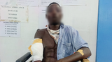 Man inflicts cutlass wounds on 25-year-old at Nzema Nkwanta