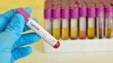 Oti Region alarmed as typhoid cases hit 22,261