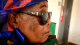 Cataract, glaucoma, and pterygium predominant in Ketu North Municipality