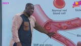 Sickle cell is not sexually transmitted – Haematologist debunks myths
