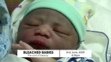 Bleached Babies: Parents who bleach their children are criminally culpable – CDD-Ghana