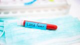 Lassa fever vaccine expected by 2032