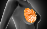 KNUST researchers develop AI model to enhance breast cancer diagnosis