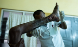 KNUST study finds long-term disabilities common among snakebite victims in Ghana